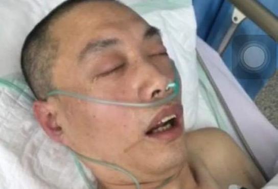 Image for article Liaoning: Uomo rimasto in coma dopo un intervento chirurgico al cervello, riportato in prigione per finire di scontare la pena 